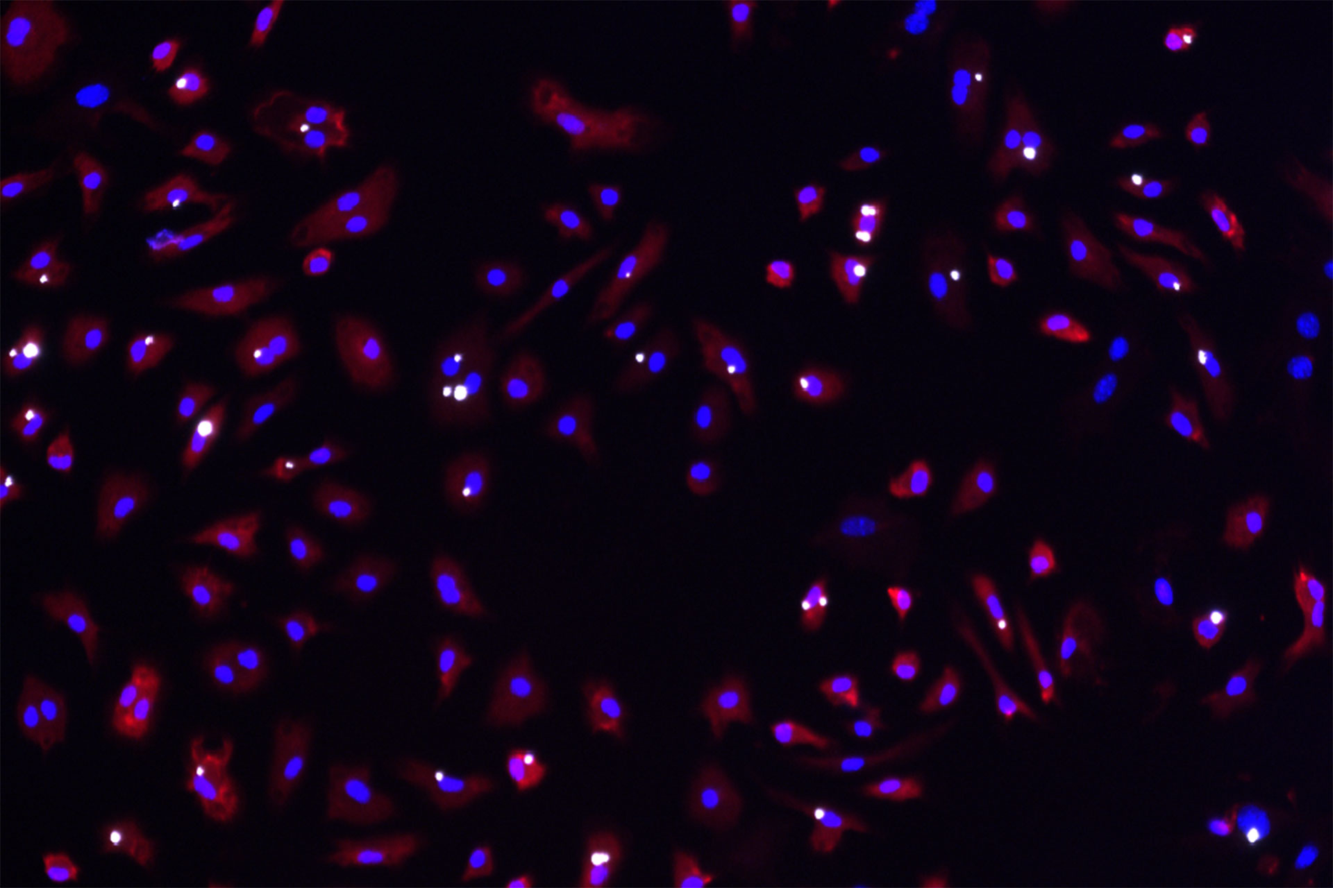 Microglia Phagocytosis