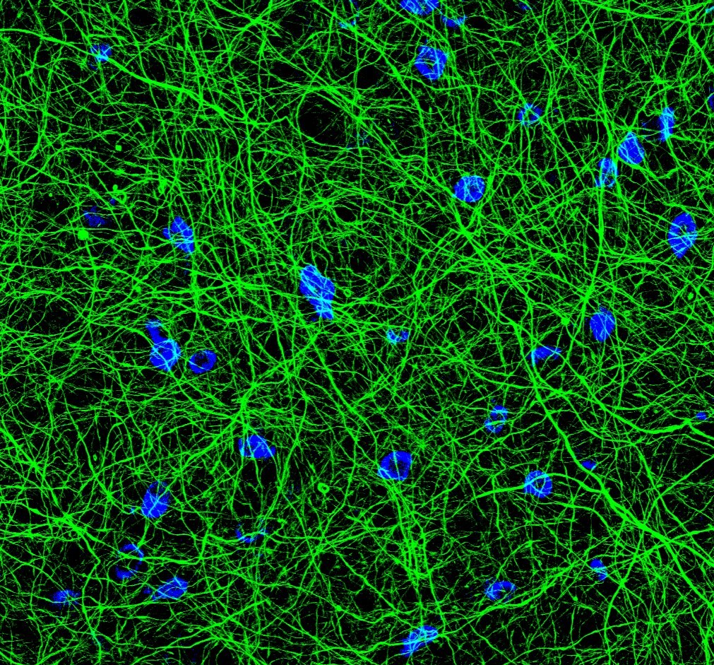 Brain slice CC1 NFH